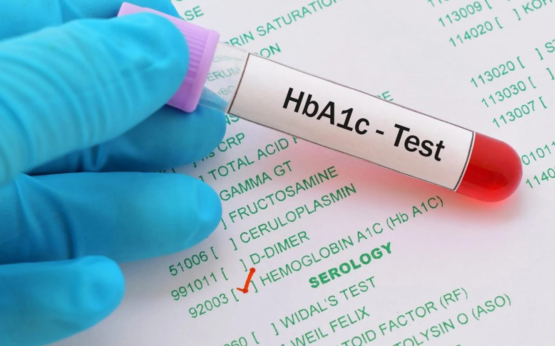 HbA1c Test Explained: Normal Range, Results & What They Mean